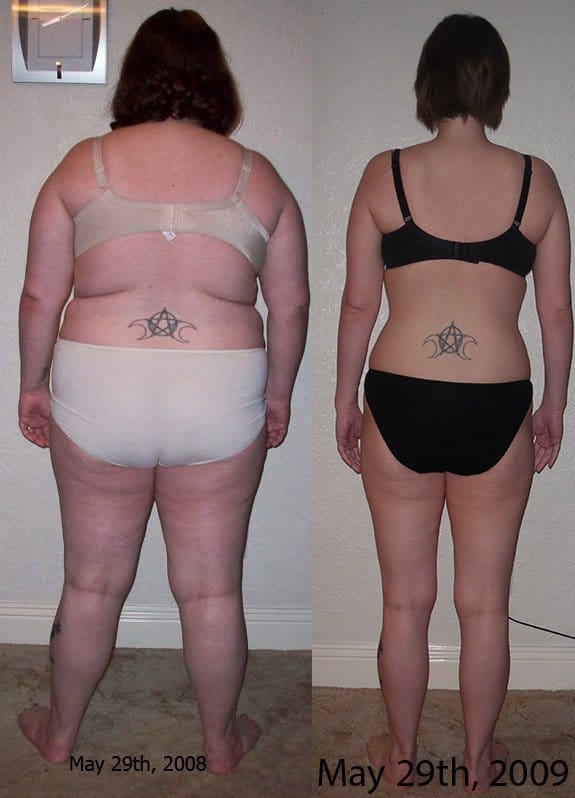 Gastric Band Average Weight Loss doubletoday