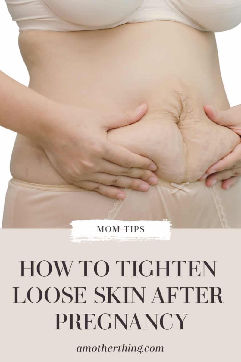 How to Tighten Loose Skin After Pregnancy | It's a Mother Thing